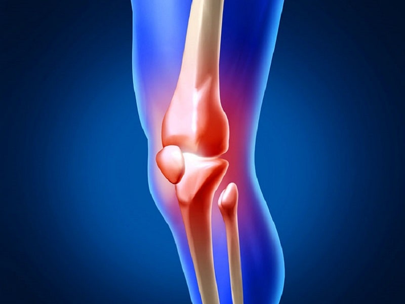 УЗД колінного суглобу