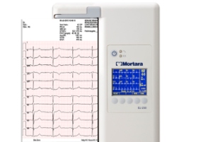 Dekodiranje EKG indikatora u odraslih - Hipertenzija February